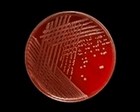 staphylococcus epidermidis colonies